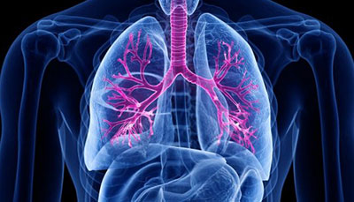 什么是慢性阻塞性肺病 (Chronic Obstructive Pulmonary Disease)，為何與新冠疫情有關(guān)？